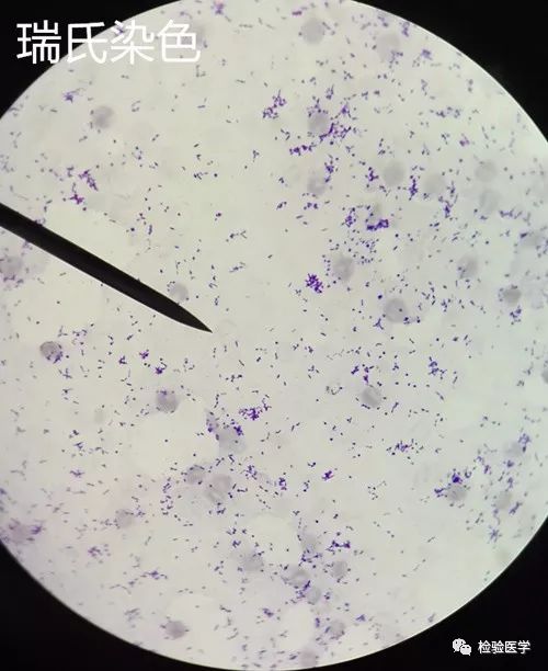 加德纳球杆菌是细菌性阴道炎的常见致病菌
