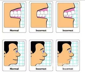 正常咬合牙齒模型圖正常咬合牙齒模型圖內側