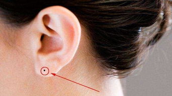 耳根有痣代表什么图片