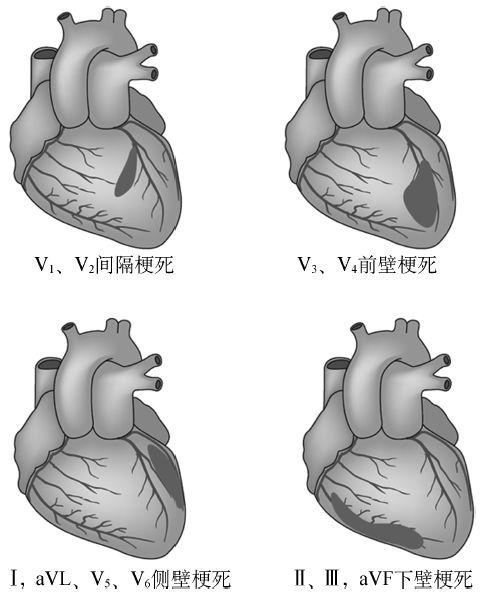 心肌損害對寶寶有什麼影響