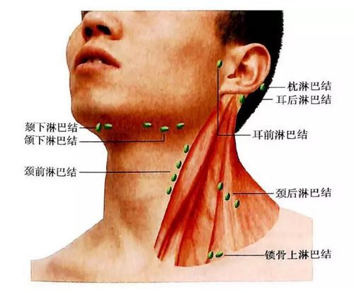 脖子淋巴结的位置图片
