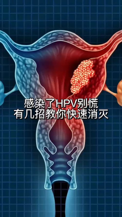 hpv病毒女性症状图片