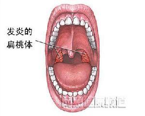 猪扁桃体位置图片