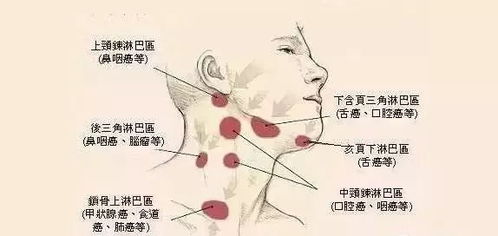 脖子淋巴结图片位置图片